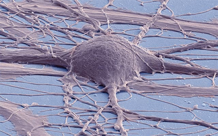 neural-stemcell-grafts