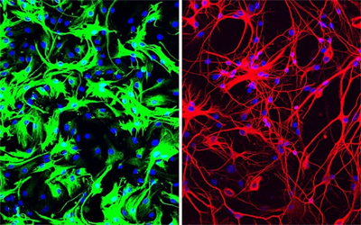 tx-generates-new-neurons